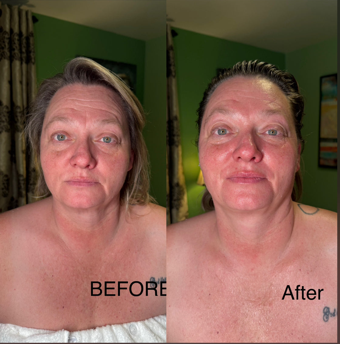 Extensive Buccal Facelift With Lymphatic Drainage & Myofacial Release Treatment 90 Minutes