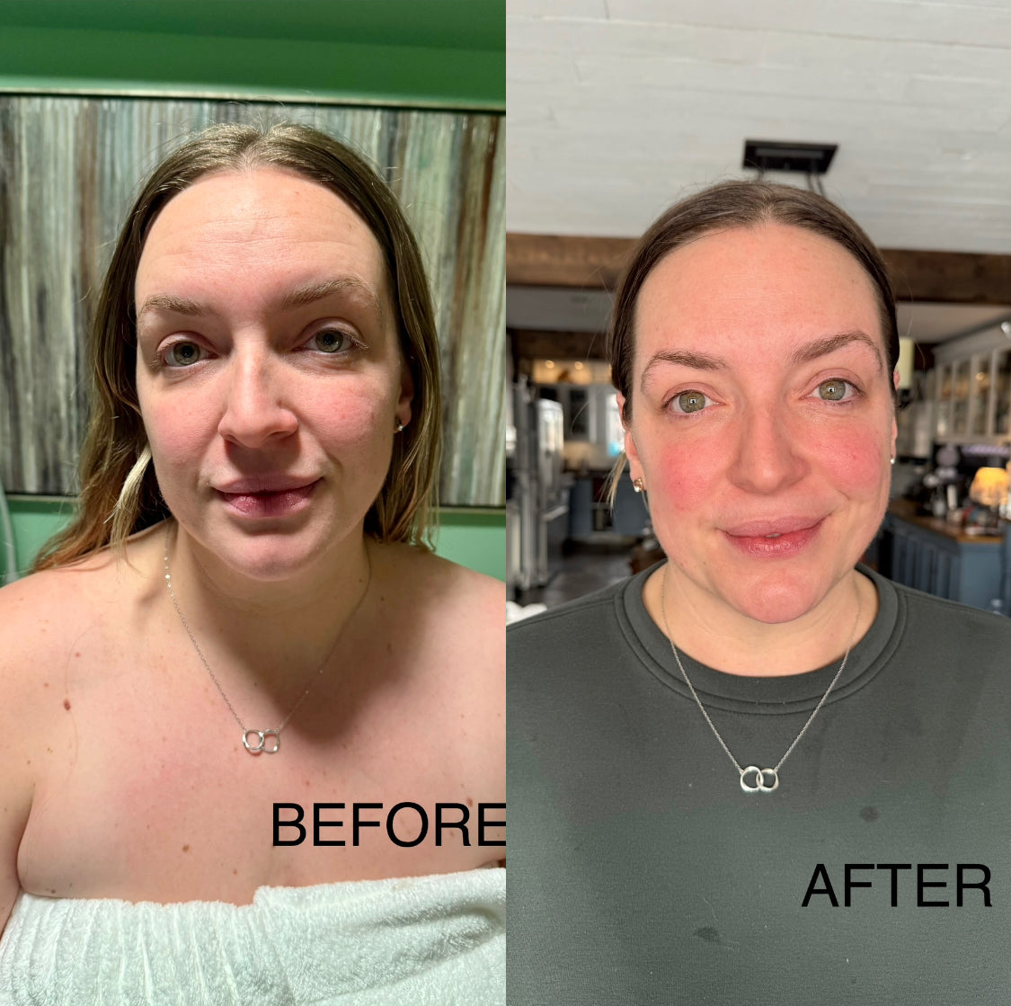 Extensive Buccal Facelift With Lymphatic Drainage & Myofacial Release Treatment 90 Minutes